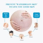 Stretch Marks Fading Cream Maternity Scars Acne Cream Pregnancy Stretch Marks Remove Cream Repair Anti-Aging Winkle Firmng Body Cream (3 PCS) - Image 3