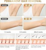 Hair Removel - Image 2